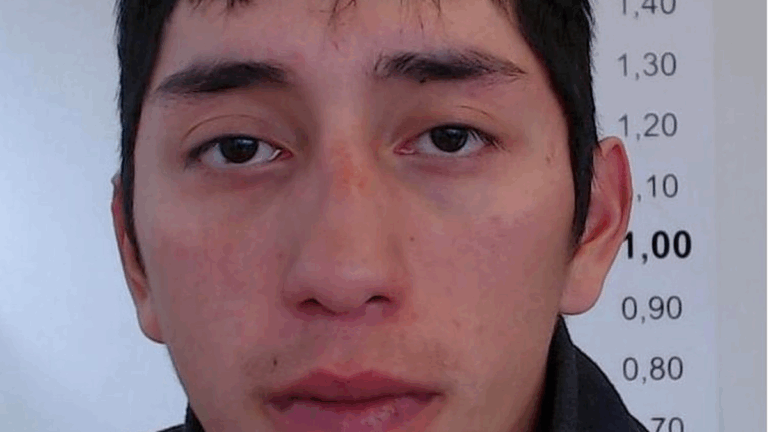 El ladrón que podría quedar paralítico ya había perdido un ojo en otro robo