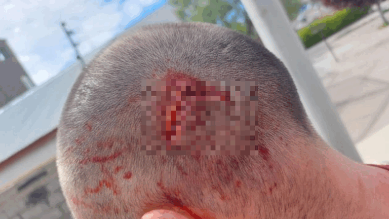 «No me mató de pedo», dijo el vecino atacado en Saavedra